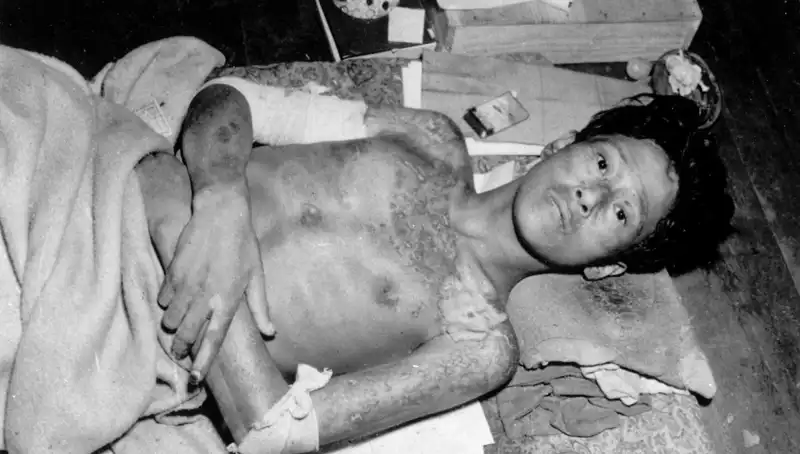 80 Yıl Sonra Nagasaki’nin Sesi: Nükleer Tehdit Yeniden Gündemde