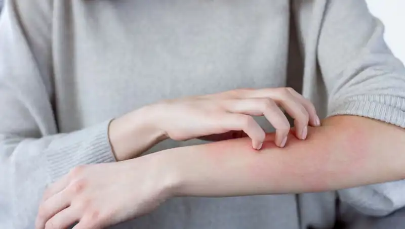 Cilt Kanseri Belirtilerini Gözden Kaçırmayın: Dermatologun Uyarıları