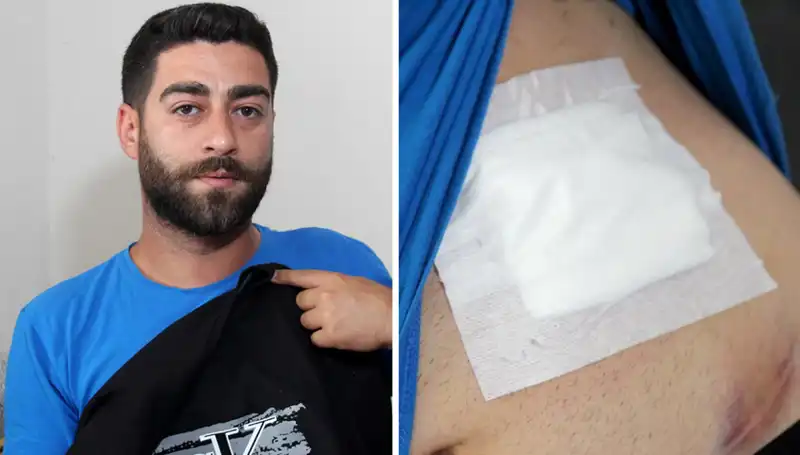 Karnında Ağrı Hissetti, Röntgen Sonuçları Şok Etti: Gerçekler Ne?