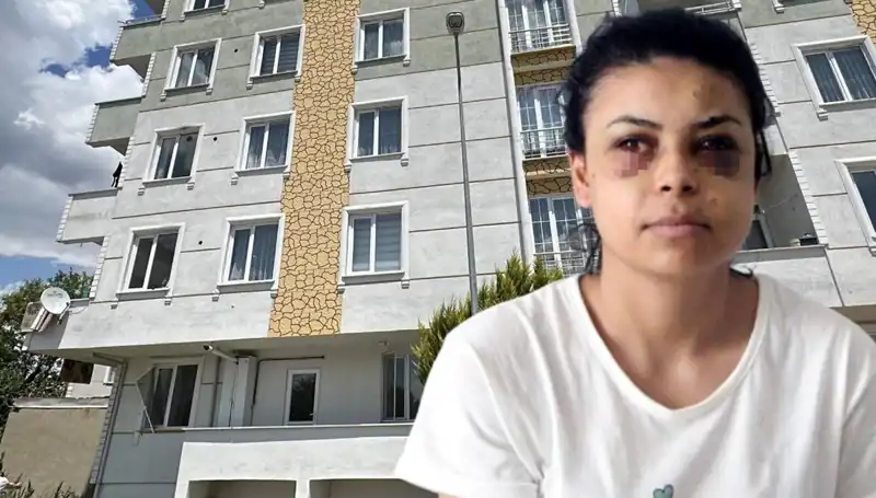 Düğün Töreninde Maganda Dehşeti: Saçmalar Genç Kızın Gözüne Isabet Etti